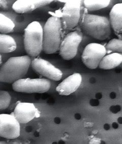 http://i648.photobucket.com/albums/uu208/Mondushi/arsenik_bacteria.jpg?t=1293305786